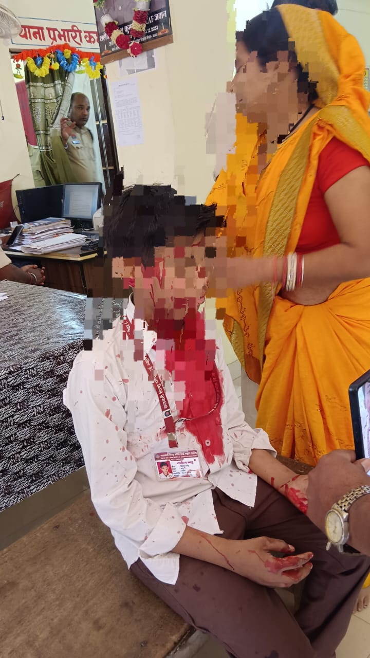 13 साल के बच्चे पर धारदार हथियार से&hellip;