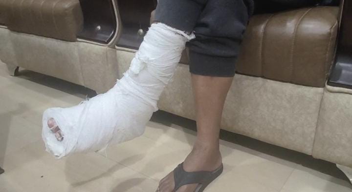 अंबिकापुर में पुलिसकर्मी की गुंडागर्दी! अधिवक्ता को बीच सड़क पर बेदम पीटा, पैर तोड़ा