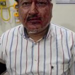 अंबिकापुर में कारोबारी से 20 लाख की सनसनीखेज लूट, जानलेवा हमले के बाद बदमाश फरार